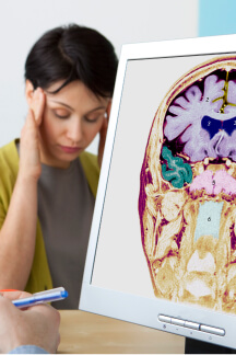 Imagem neurologia funcional